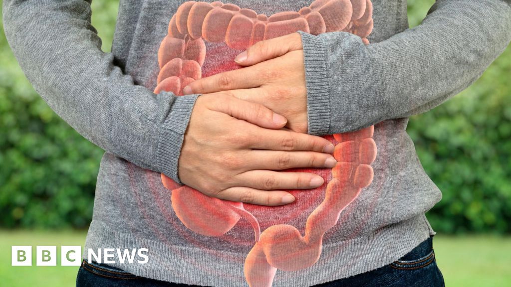 Read more about the article Bowel-cancer rates rising among younger people