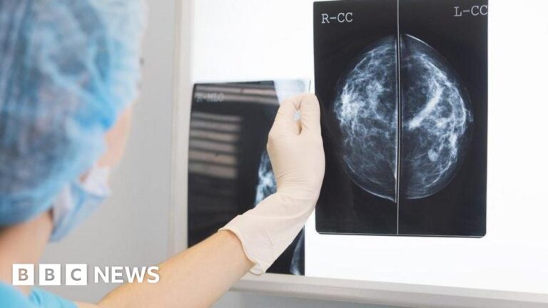 Read more about the article Cancers getting diagnosed at earlier stages