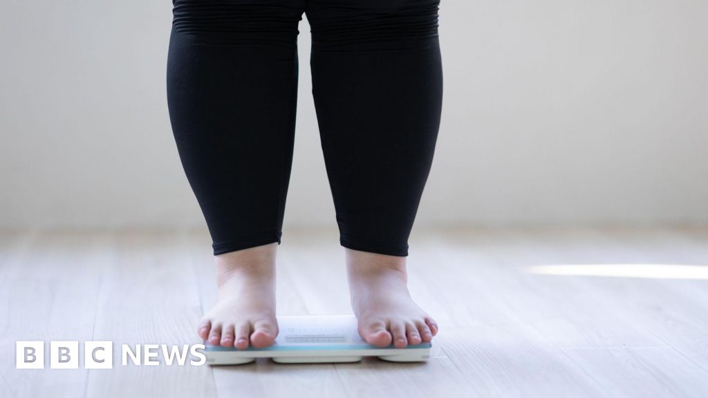You are currently viewing More than 50% of adults predicted to be obese by 2050 worldwide