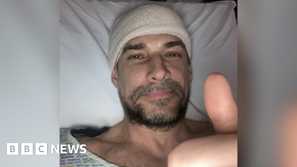 Read more about the article Protein film actor Craig Russell ‘lucky’ to see film after brain tumour