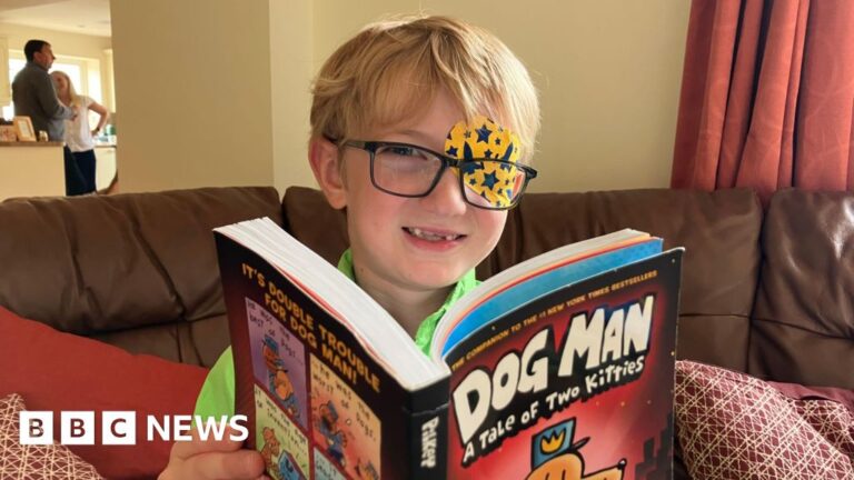 Read more about the article Screen children in schools to find lazy eyes early, experts say