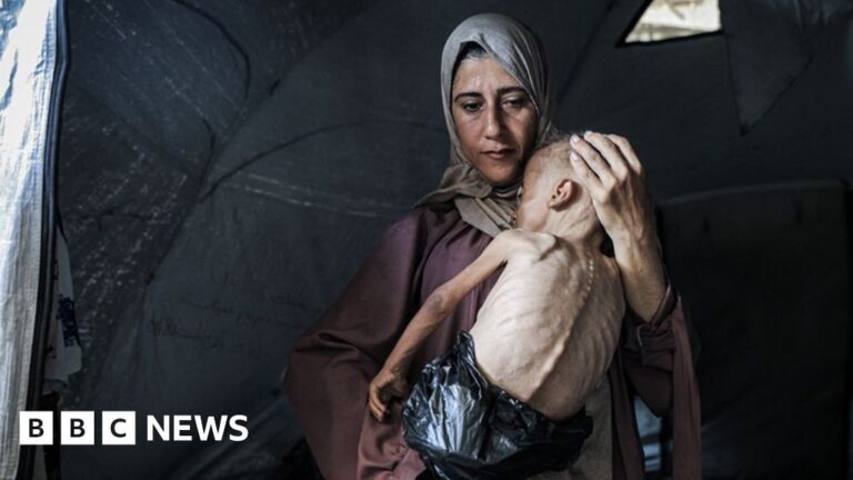 Read more about the article Mother of starving baby speaks to BBC