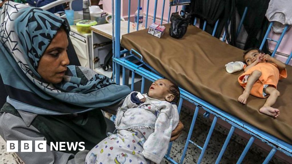 One in five children in Gaza City is malnourished, UN aid agency says