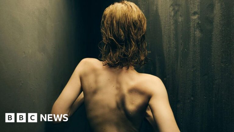 Read more about the article Is super skinny back? UK sees rise in complaints over thin models