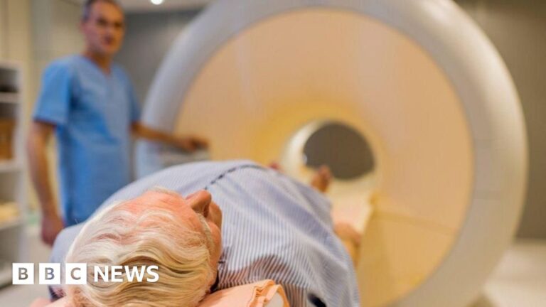 Read more about the article Men being over-treated for prostate cancer, says charity